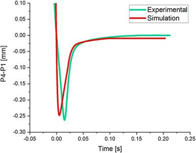 Investigation of crystalline lens overshooting: ex vivo experiment and optomechanical simulation results